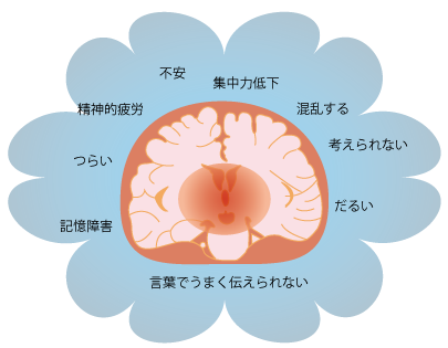 ブレインフォグ☆さいたま市の漢方薬局もも木薬局